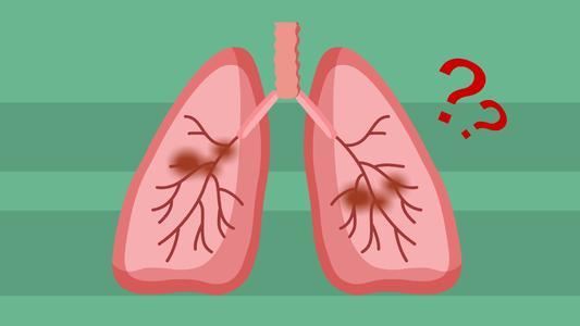 研究表明雾化装置中的热量是造成肺损伤的原因