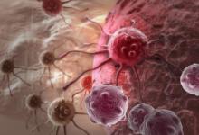 增强图像内窥镜检查比常规成像更有效地检测上消化道癌