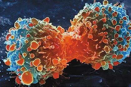 研究发现治疗侵袭性癌细胞的潜在靶标
