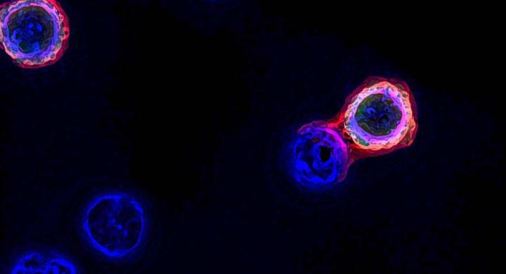 分离靶向肿瘤T细胞的快速方法可推动个性化癌症治疗