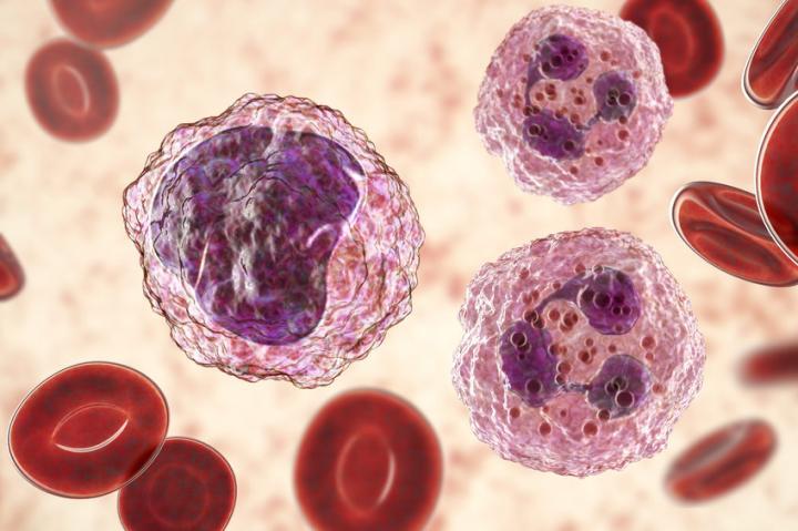研究人员发现抗白血病新方法