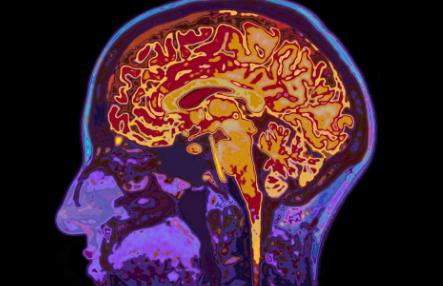 最新研究发现您的大脑可能比您的身体还老