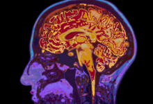 最新研究发现您的大脑可能比您的身体还老