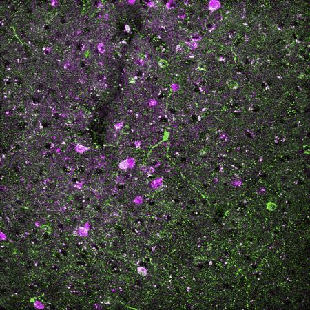 一些神经元靶向微小的脑血管扩张