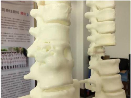仿生脊柱可能为新的麻痹治疗铺平道路