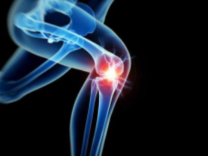 科学家发现骨关节炎样膝关节软骨变性的新治疗目标