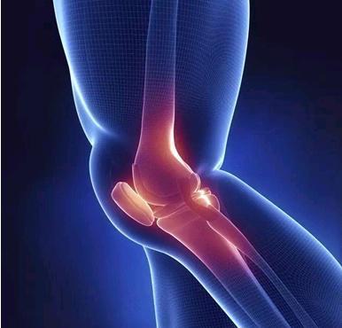 简单的膝盖注射有可能阻止骨关节炎的发作