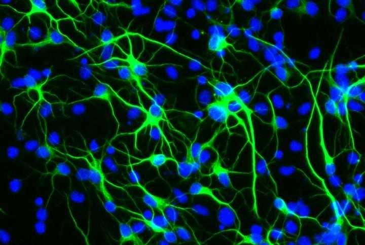 研究揭示了长寿基因如何保护脑干细胞免受压力