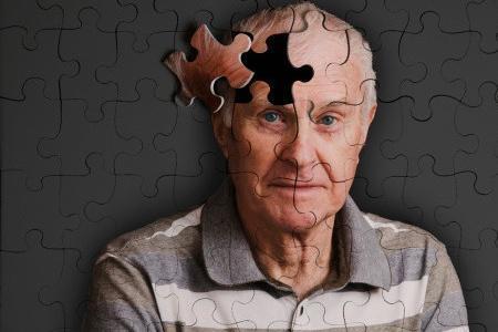 研究人员发现了一种新的方法来诊断潜在的阿尔茨海默氏病