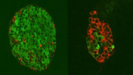 将细胞转化为产生胰岛素的细胞的抗体可以治愈该疾病的小鼠模型