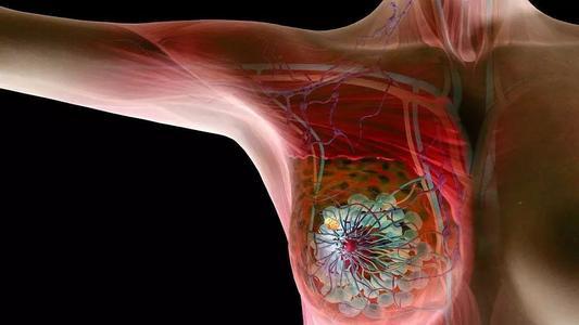 参加连续的乳腺X光检查可以预防乳腺癌的死亡