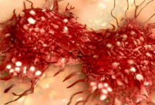 新型抑制剂可抗药性肿瘤细胞