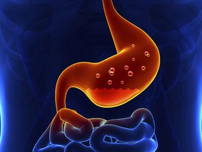 基因和蛋白质的变异加重了一种胃肿瘤的预后