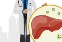 自体攻击性免疫细胞在非酒精性脂肪性肝炎中引起肝脏免疫病理